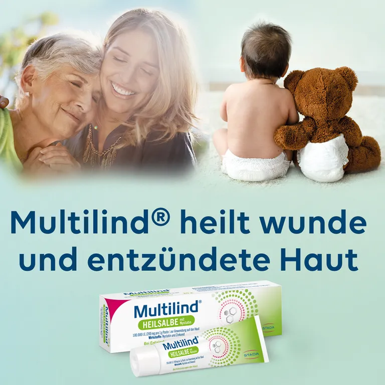 shopapotheke Multilind® Heilsalbe bei wunder und entzündeter Haut mit Zinkoxid und Nystatin - Jetzt 20% mit dem Code stada20 sparen* Rabatte dieses Monats