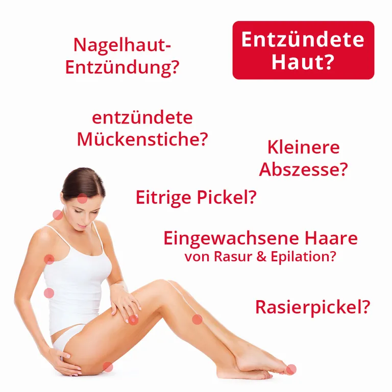 shopapotheke ilon® Salbe classic bei Entzündungen der Haut Kostenloser Versand
