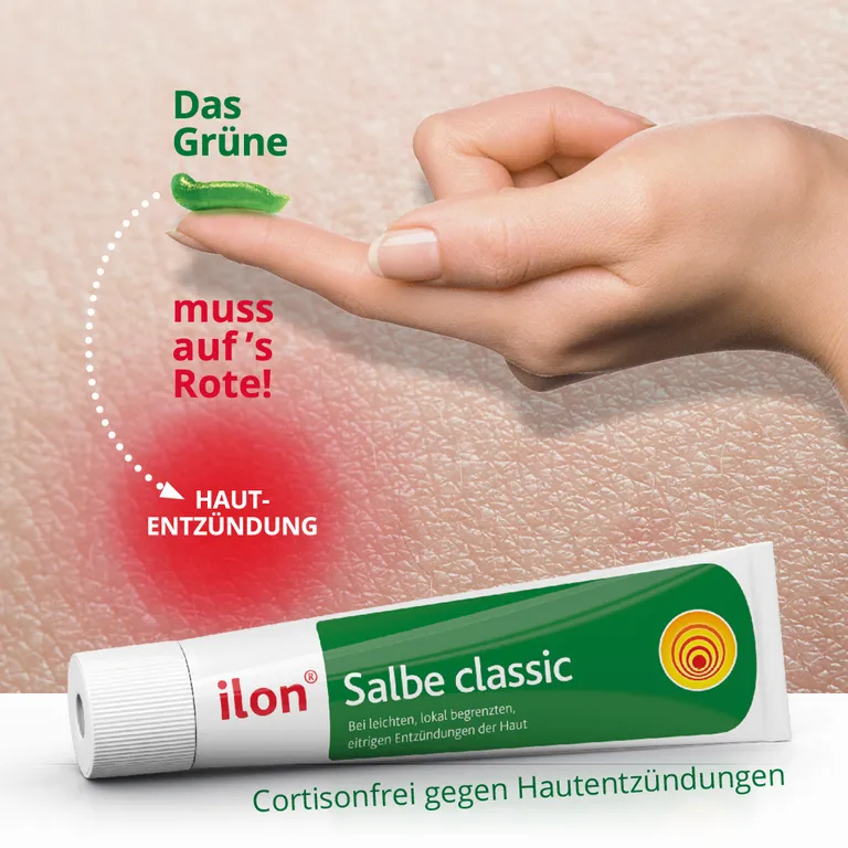shopapotheke ilon® Salbe classic bei Entzündungen der Haut Kostenloser Versand