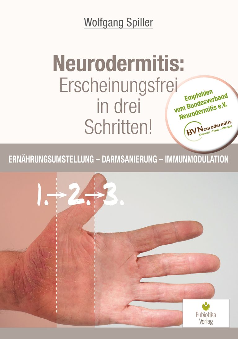 shopapotheke Neurodermitis: Erscheinungsfrei in drei Schritten VIP-Rabatte