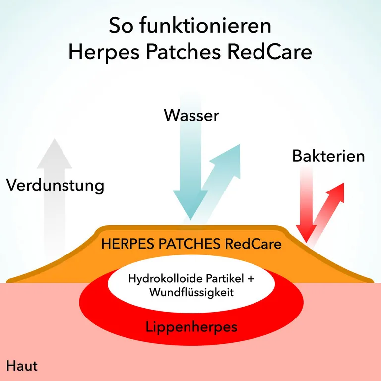 shopapotheke Redcare Herpes Patches JETZT KAUFEN