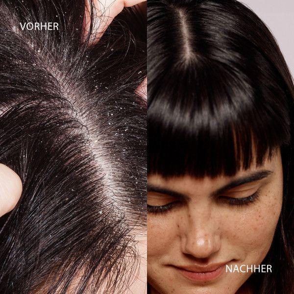 bodyguardapotheke DUCRAY KELUAL DS Anti-Schuppen-Shampoo Online
