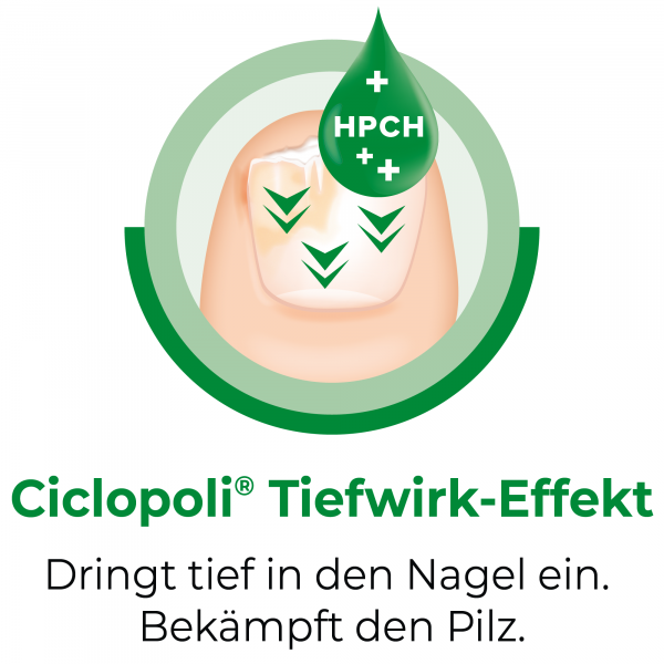 bodyguardapotheke CICLOPOLI gegen Nagelpilz wirkstoffhalt.Nagellack Nur für heute