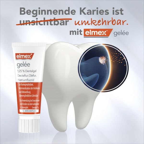 bodyguardapotheke elmex gelée Zahnpasta zum Schutz vor Karies und Zahnschmerzen Nur noch ein Tag übrig