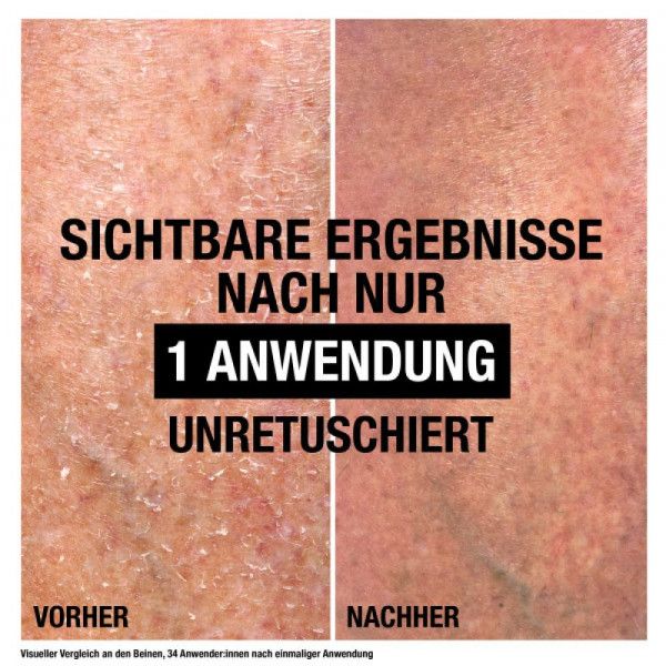 bodyguardapotheke NEUTROGENA Intense Repair CICA Bodybalsam Vatertagsangebot