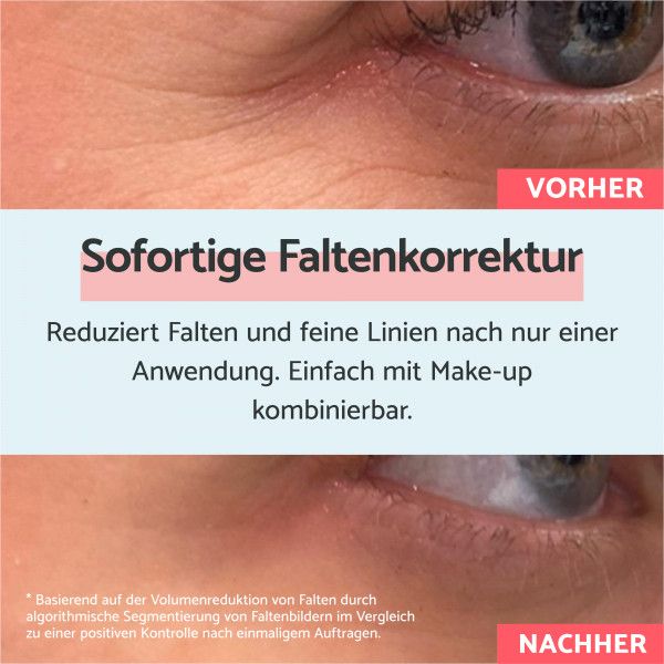 bodyguardapotheke Remescar Anti-Falten-Creme mit Soforteffekt 8ml Begrenzt auf 3 Tage