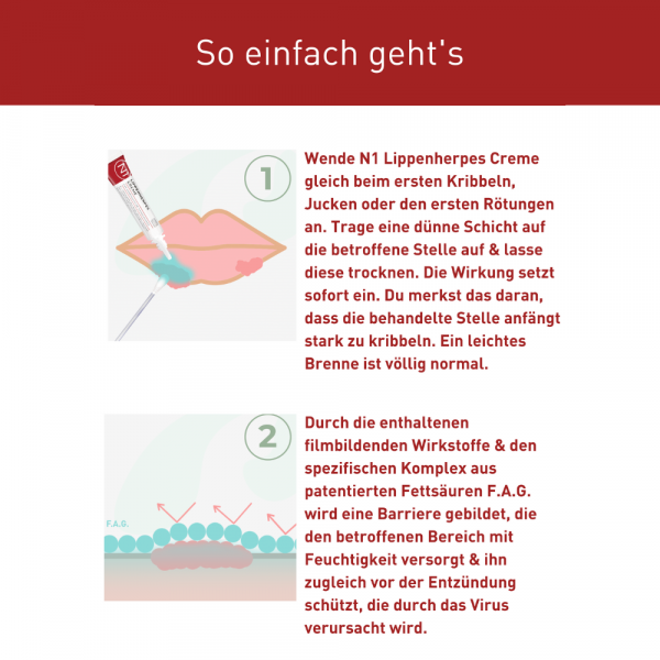 bodyguardapotheke N1 LIPPENHERPES Creme Preisnachlass