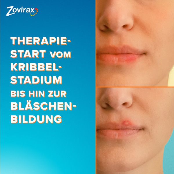bodyguardapotheke ZOVIRAX Lippenherpes Creme Valentinstagsangebot