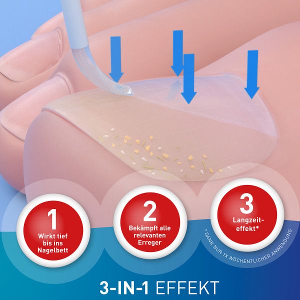 bodyguardapotheke LOCERYL Nagellack gegen Nagelpilz DIREKT-Applikat Bis zu 65% Rabatt