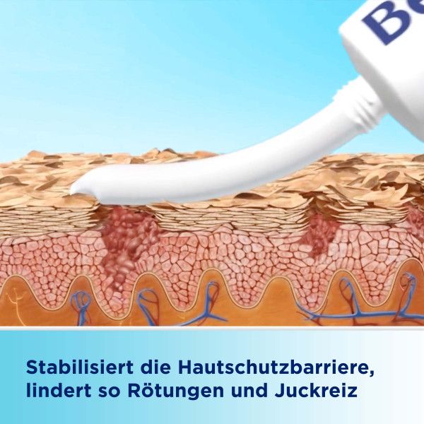 bodyguardapotheke BEPANTHEN Sensiderm Creme zur Linderung bei geröteten juckenden Hautstellen durch Stabilisierung der Hautbarriere Heißer Verkauf