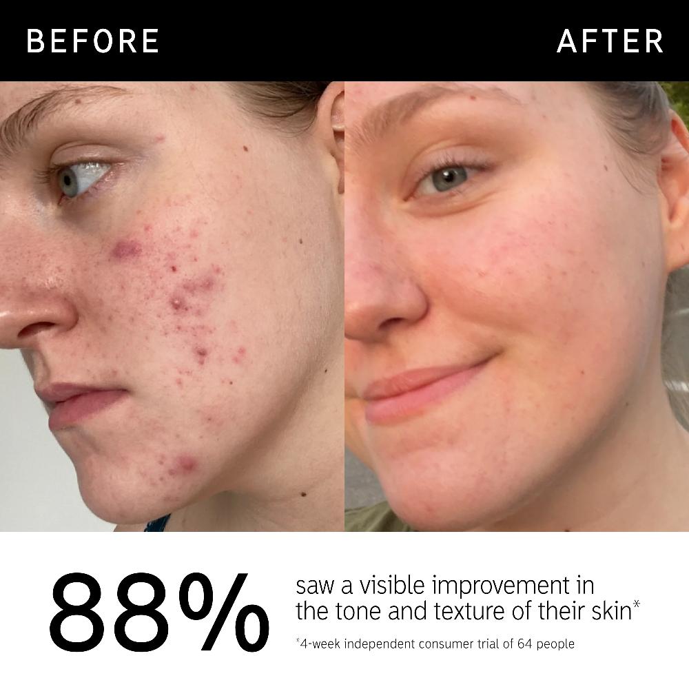 lookfantastic The INKEY List 15% Vitamin C und EGF Serum 30 ml Saisonale Angebote