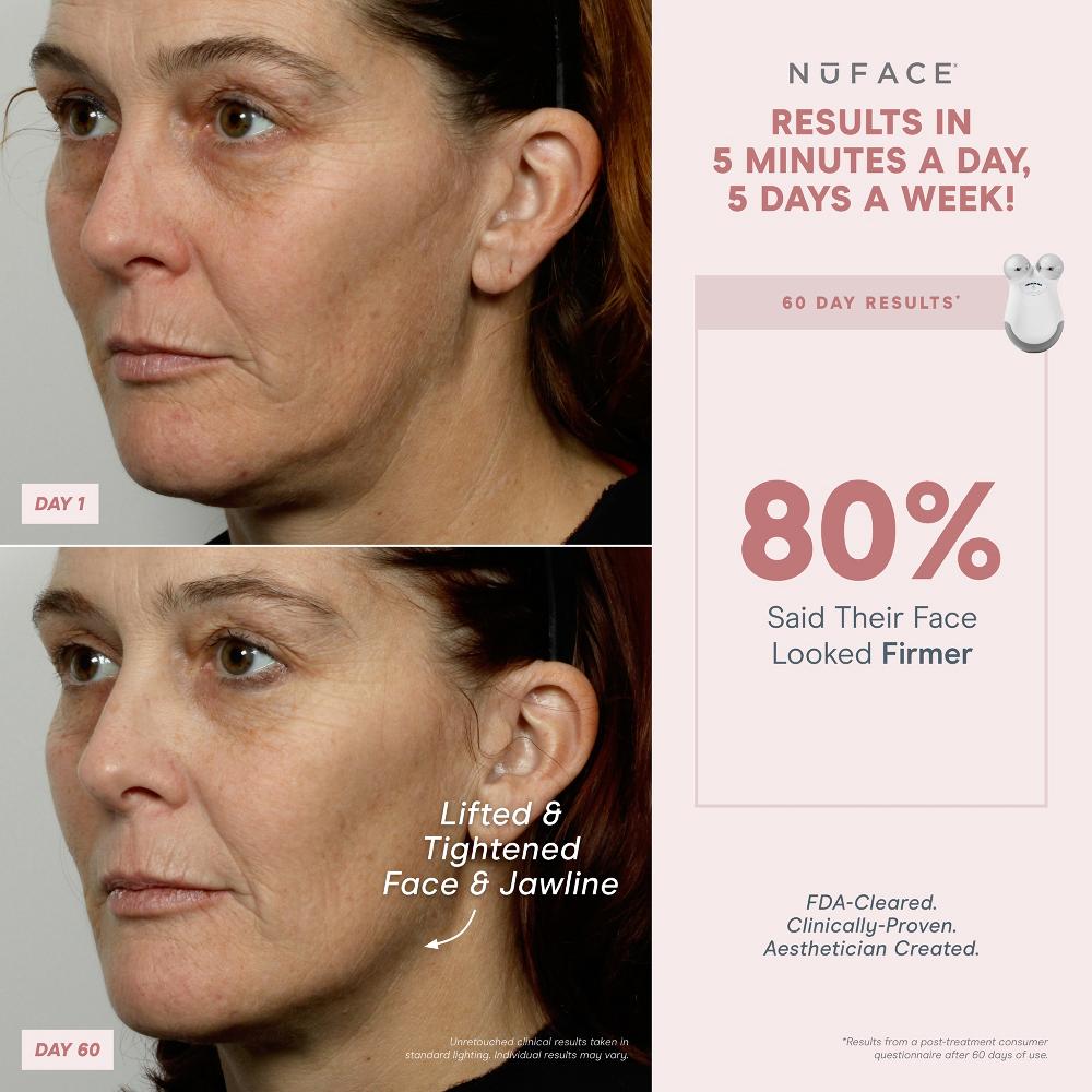 lookfantastic NuFACE® Mini Starterkit Black Friday