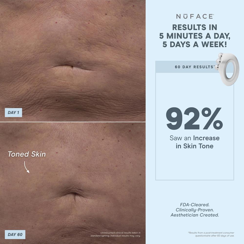 lookfantastic NuBODY by NuFACE 50% Rabatt mit kostenlosem Versand
