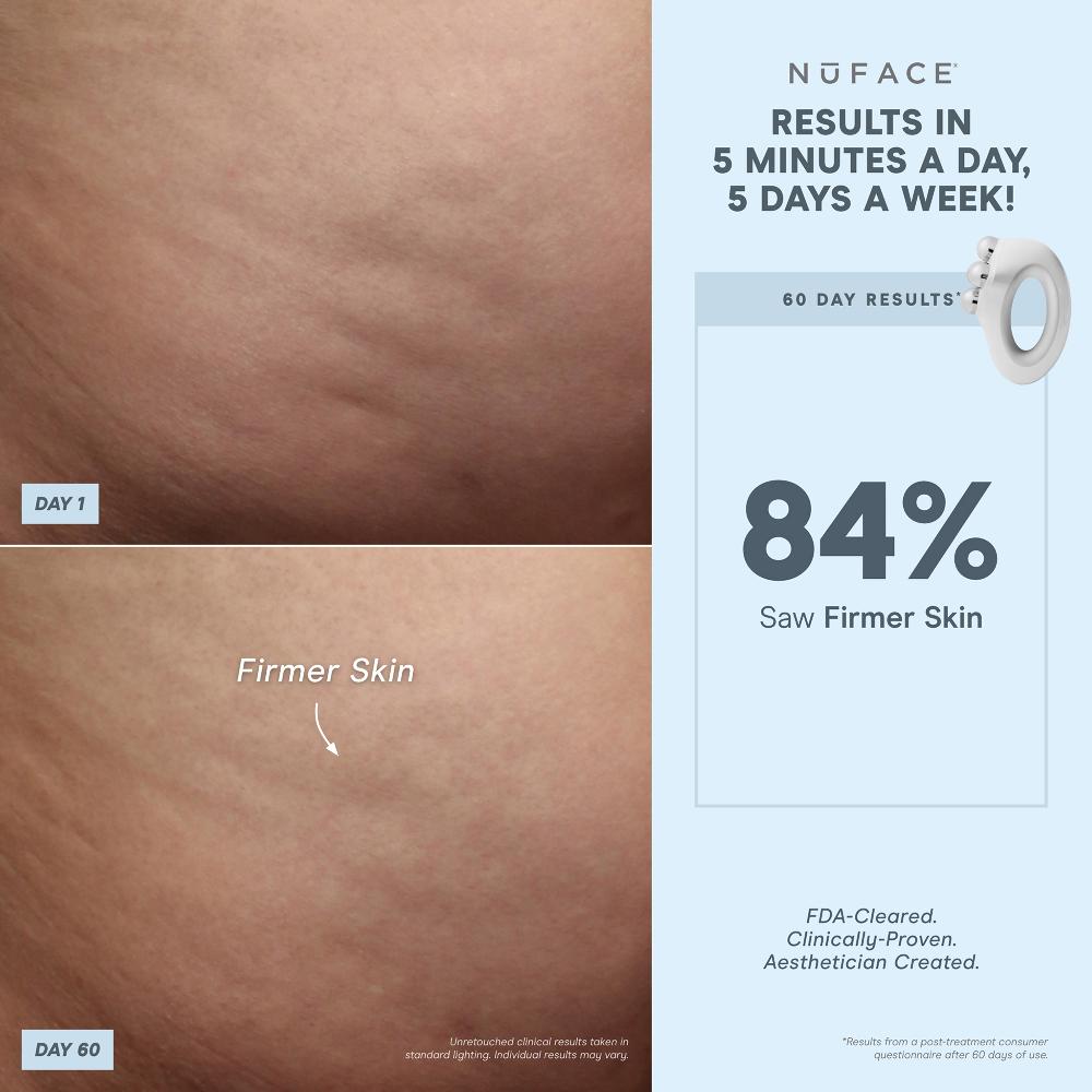 lookfantastic NuBODY by NuFACE 50% Rabatt mit kostenlosem Versand