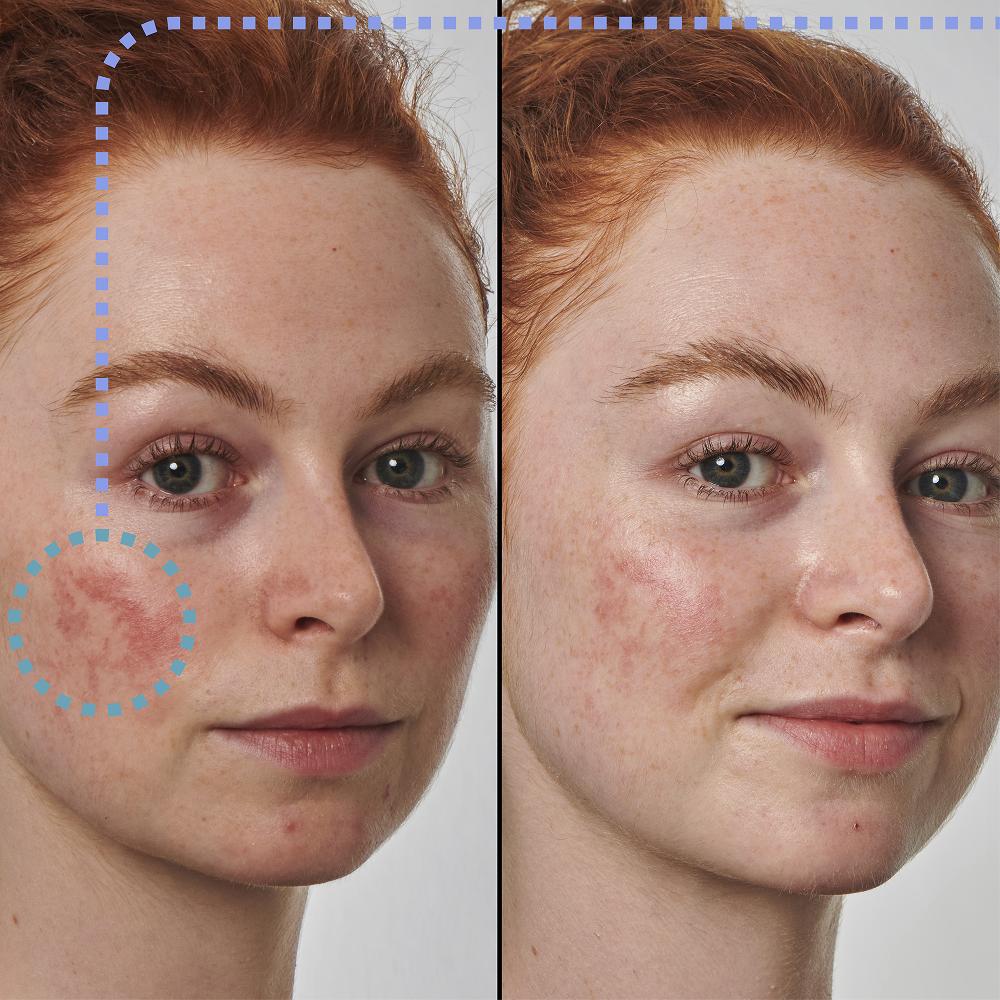 lookfantastic The INKEY List Super Solutions 10 % Azelainsäure-Serum 30 ml Fabrikverkauf