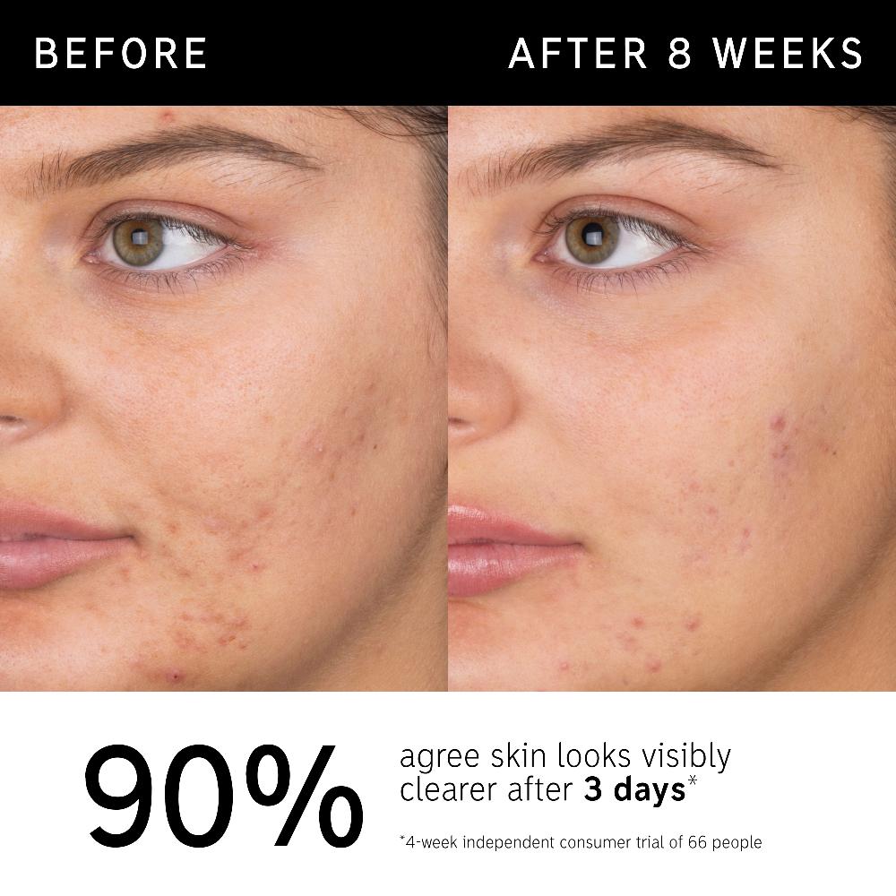 lookfantastic The INKEY List Salizylsäure-Gesichtsreinigung 150 ml Blitzverkäufe