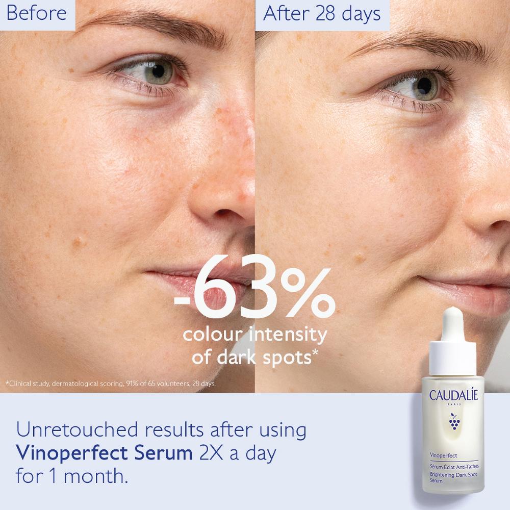 lookfantastic Caudalie Vinoperfect Aufhellendes Serum Gegen Dunkle Flecken 30 ml Versandkostenfrei