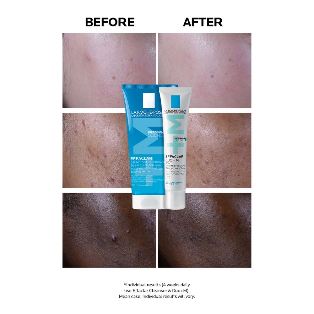 lookfantastic La Roche-Posay Effaclar Duo+M Unreinheitenkorrigierende Gel-Feuchtigkeitspflege für Fettige zu Unreinheiten Neigende Haut 40 ml Hotsell
