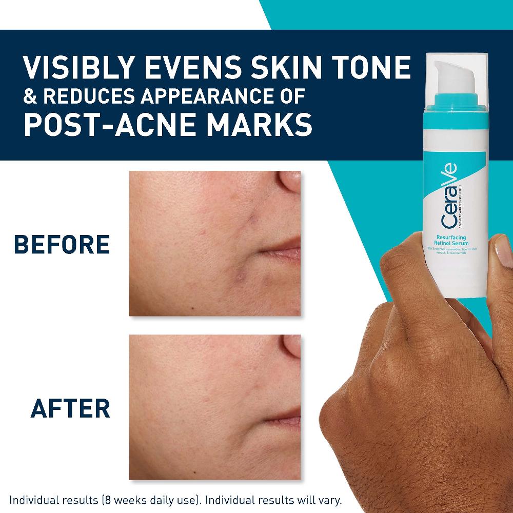 lookfantastic CeraVe Resurfacing Retinol Serum with Ceramides and Niacinamide for Blemish-Prone Skin 30ml Riesige Ersparnisse