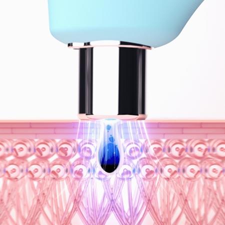 FOREO FOREO KIWI™ Vakuum-Mitesserentferner mit blauem LED-Licht Günstig kaufen