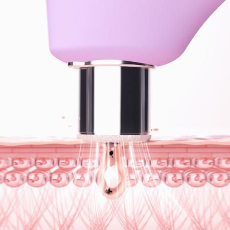 FOREO FOREO KIWI™ Derma Ausrüstung für Diamant-Mikrodermabrasion und Porenreinigung Riesige Rabatte